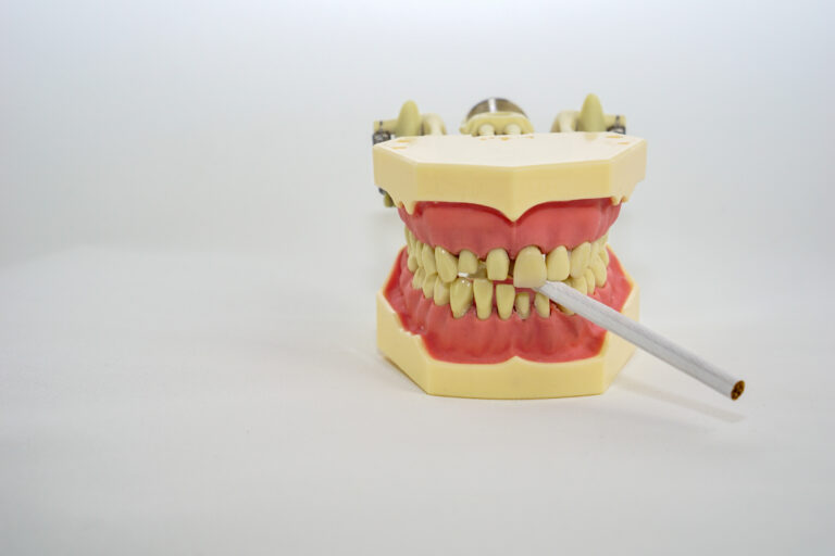 A dental model with yellowed teeth holds a cigarette, symbolizing the effects of smoking on oral health, alongside a toothbrush.